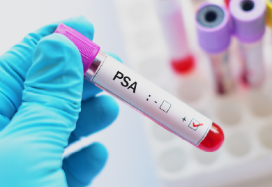 Exame de PSA