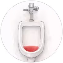 Sangue na urina
