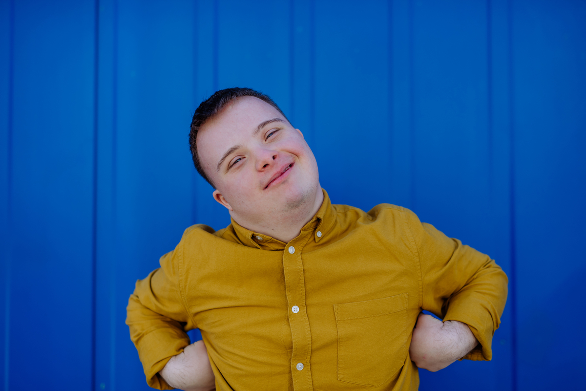 síndrome de down