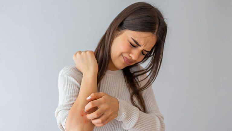 8 de julho dia Mundial da Alergia