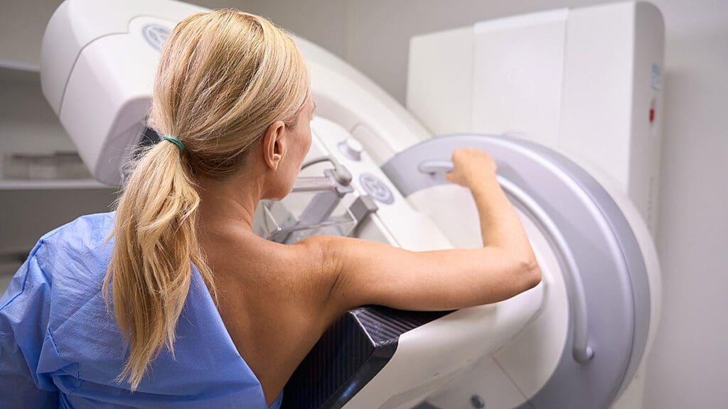mamografia