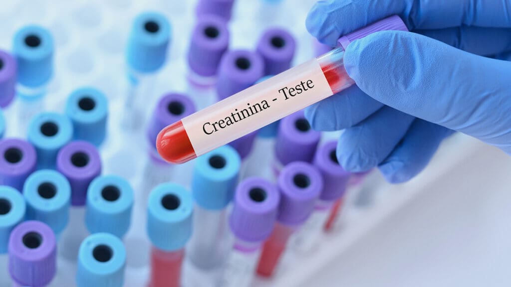 creatinina