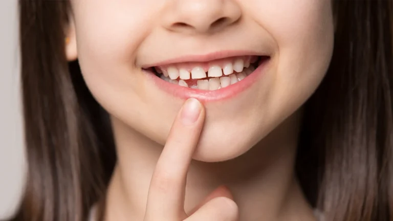Dente de leite