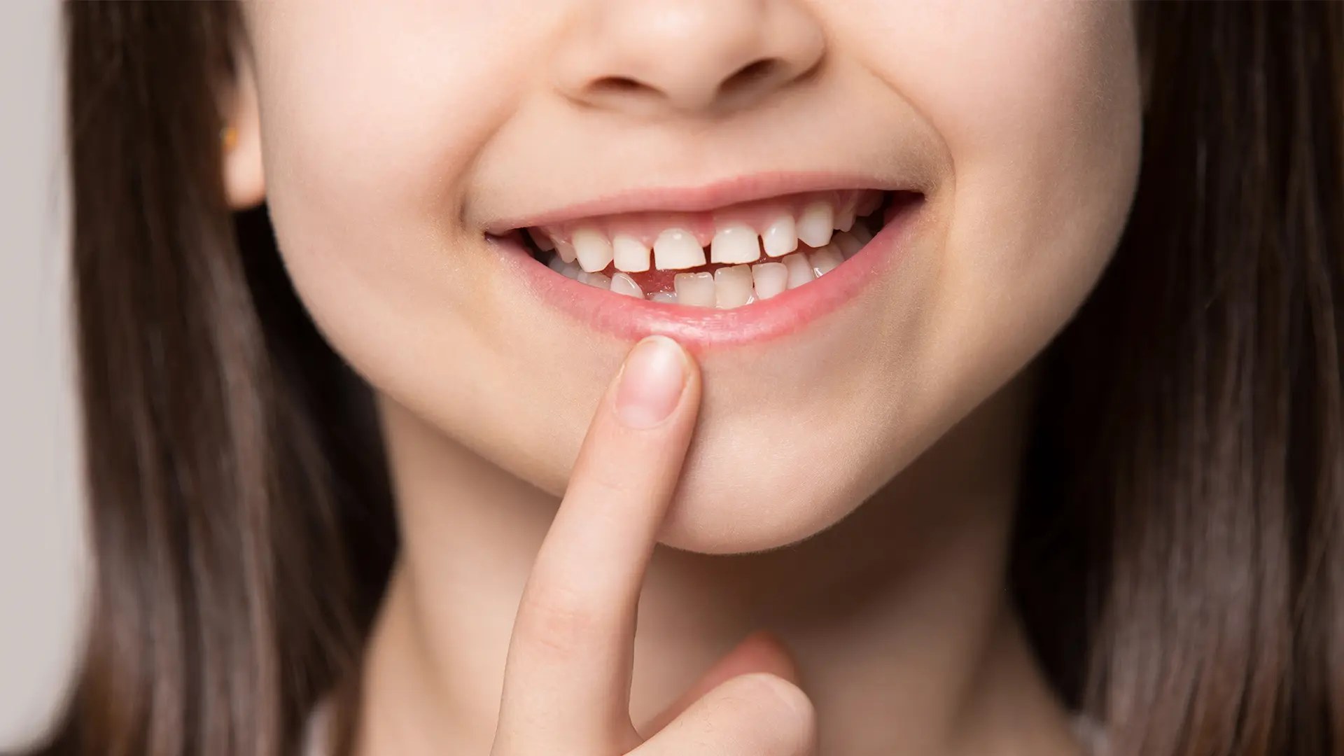 Dente de leite